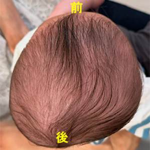 ステップ1
